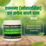 eczema psoriasis powder | एक्ज़िमा (सोरायसिस) - Image 2